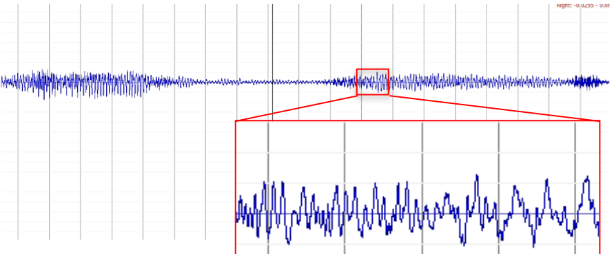 sound-wave-img